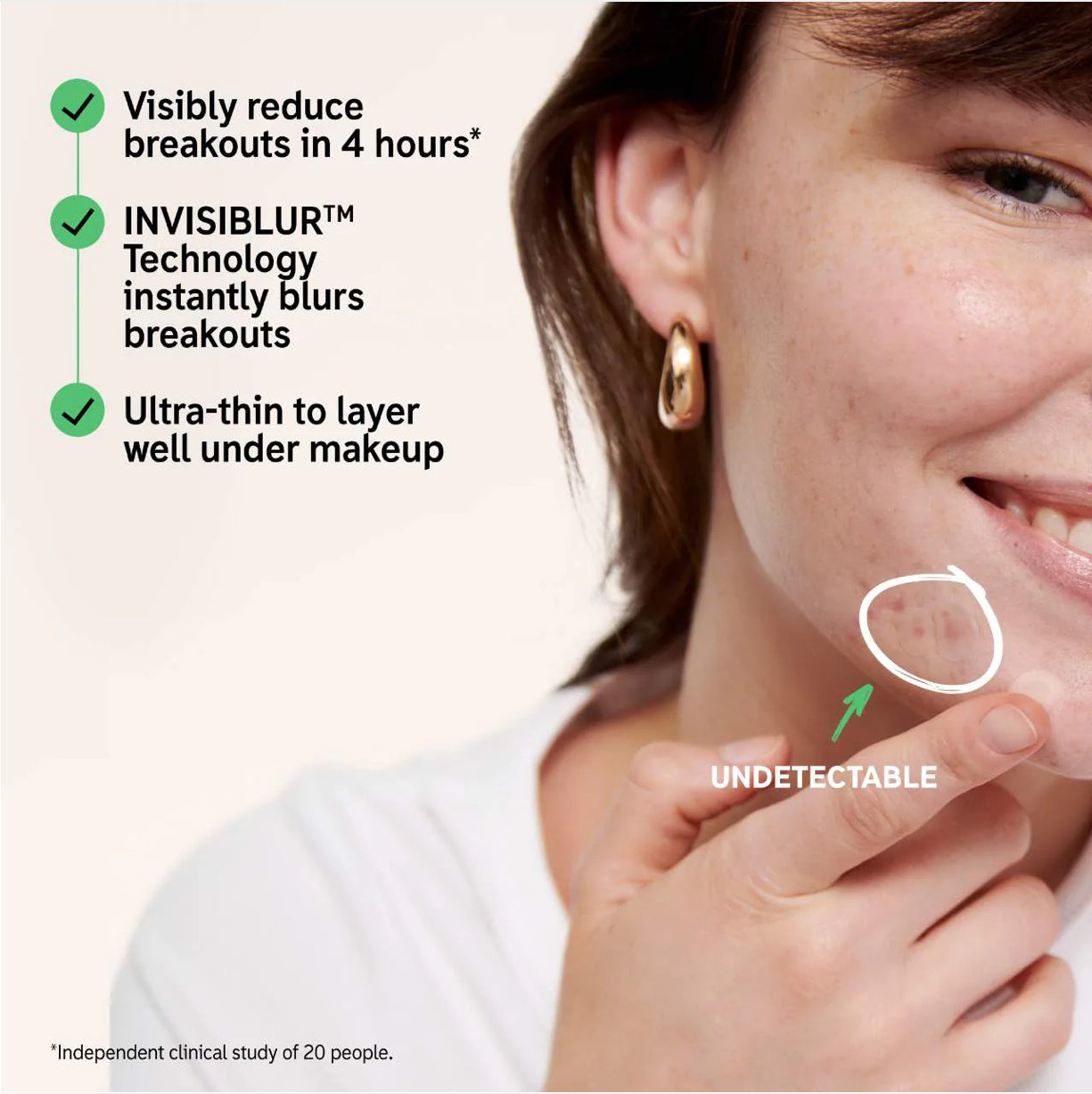 The Inkey List - Hydrocolloid Invisible Pimple Patches + Salicylic Acid