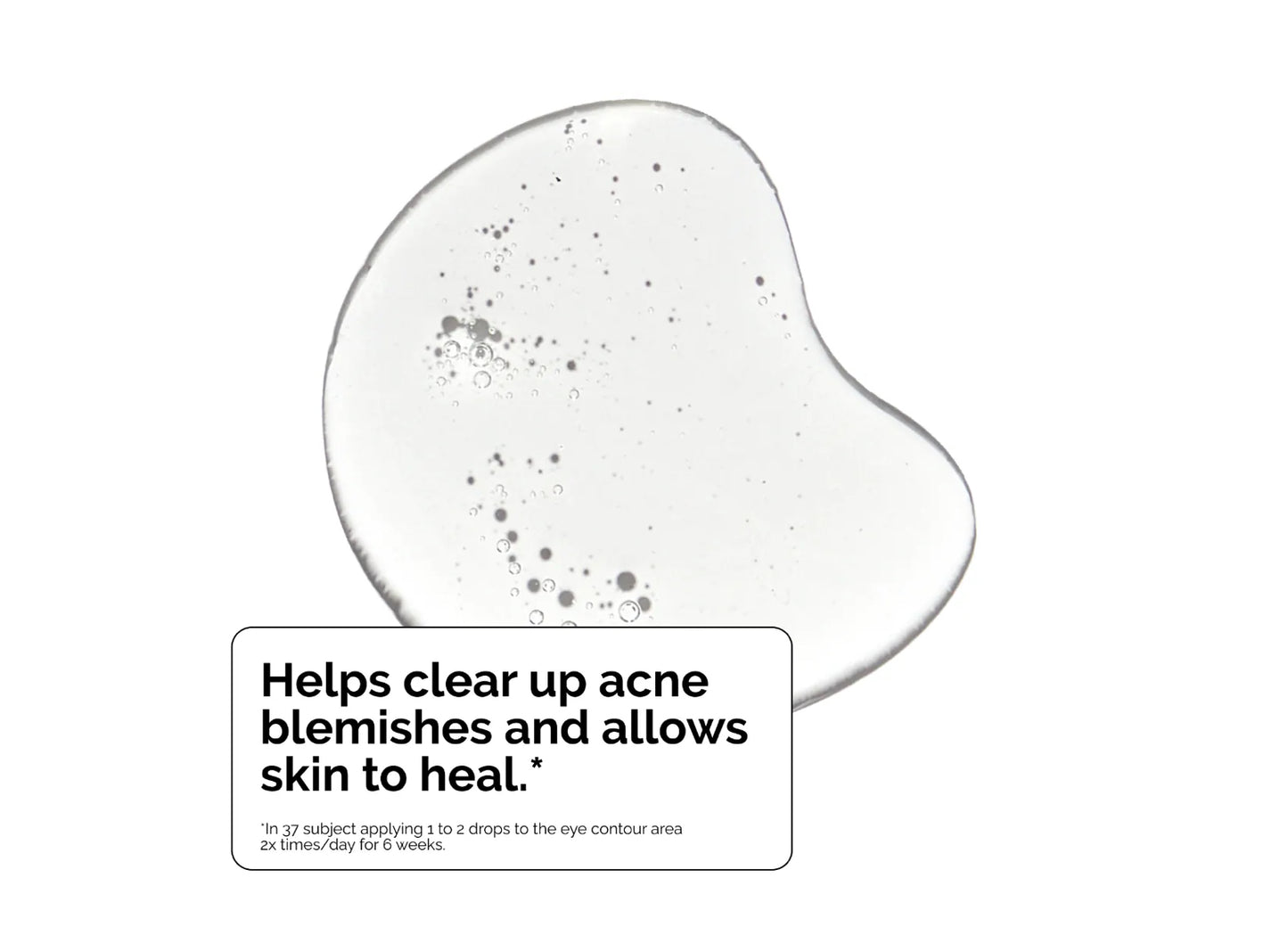 The Ordinary - “Salicyclic Acid”