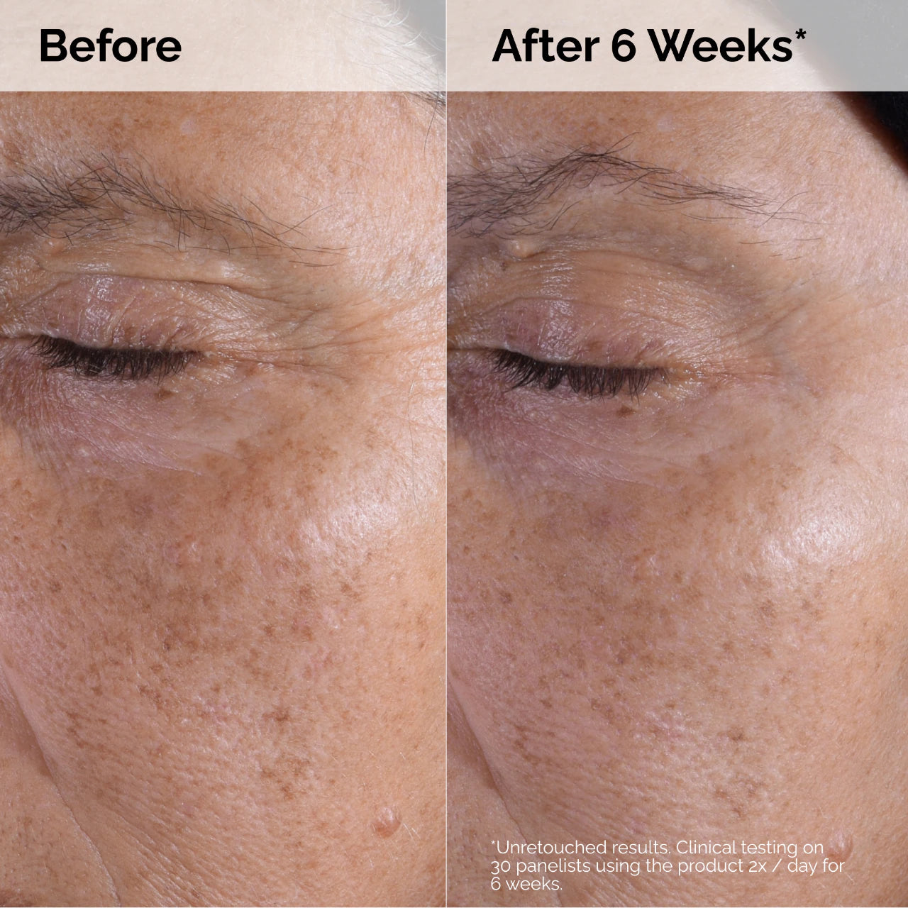 The Ordinary - “Glycolic Acid 7% Toner”