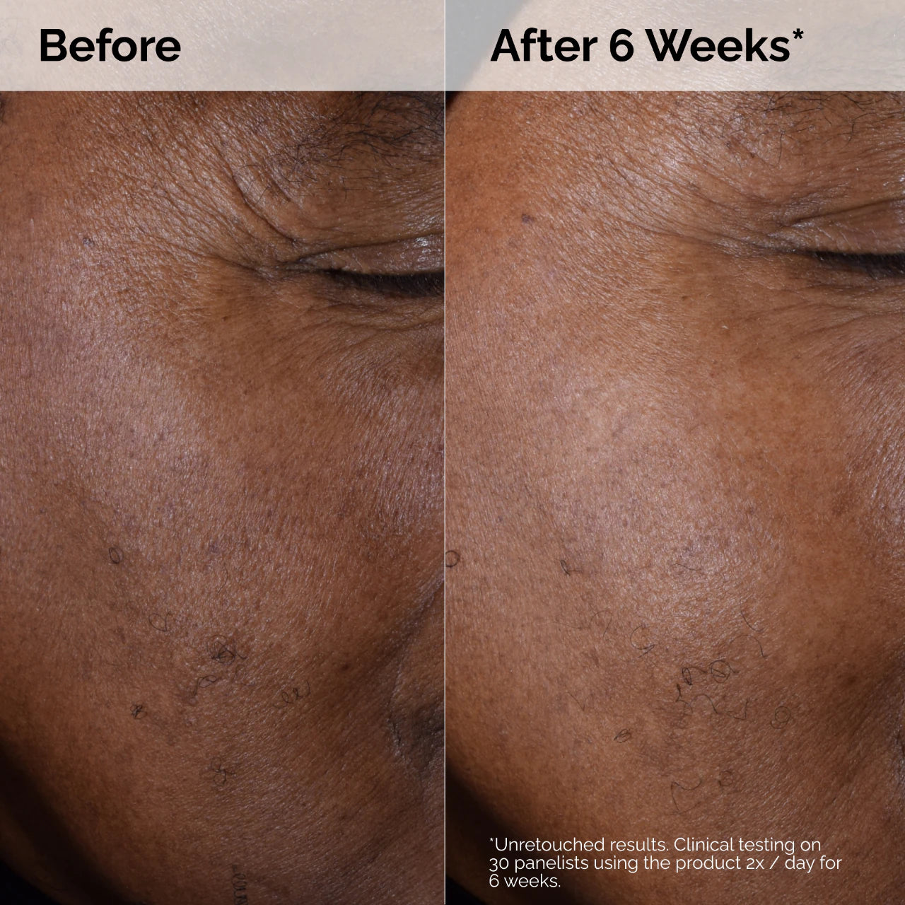 The Ordinary - “Glycolic Acid 7% Toner”