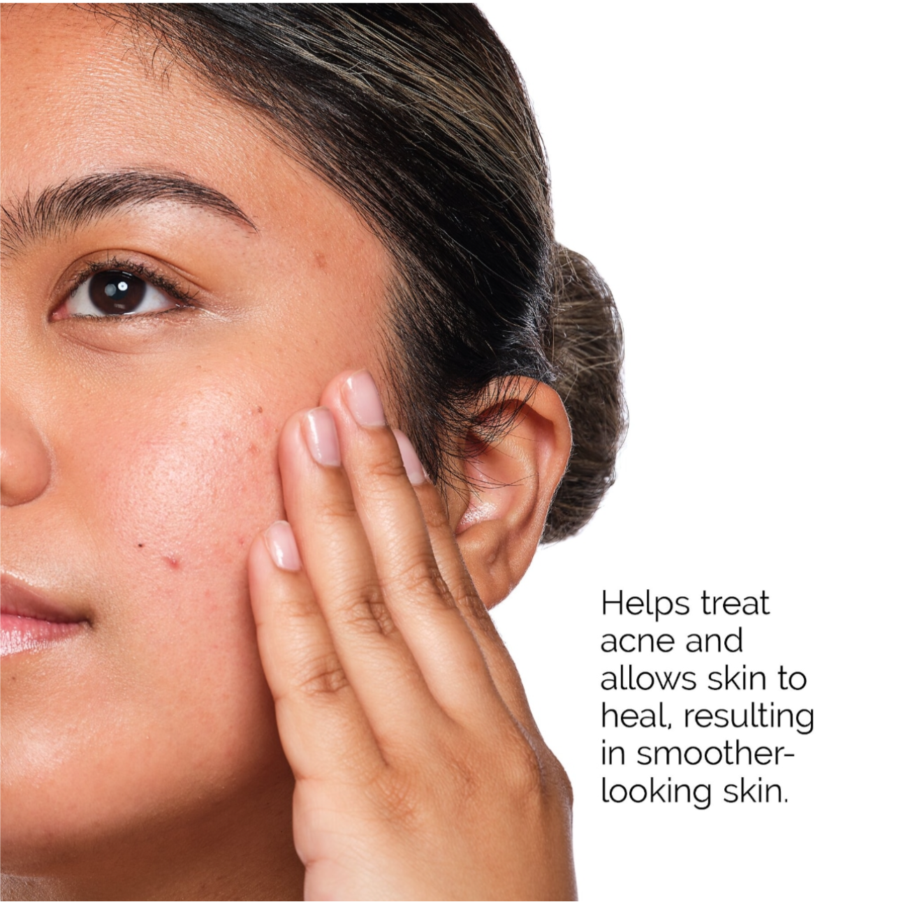 The Ordinary - “The Acne Set”
