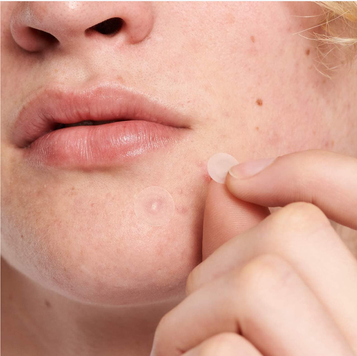 The Inkey List - Hydrocolloid Invisible Pimple Patches + Salicylic Acid