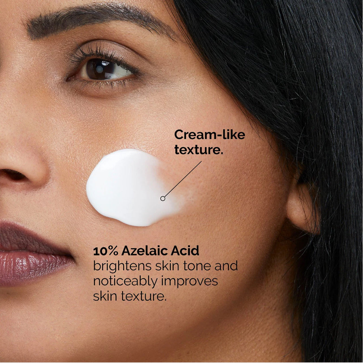 The Ordinary - Azelaic Acid Suspension 10%