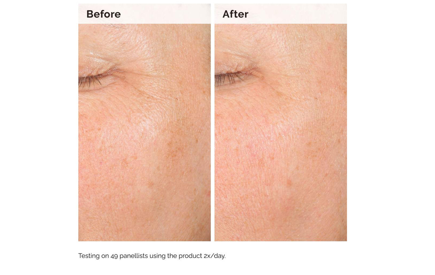 The Ordinary Alpha Arbutin 2% + HA