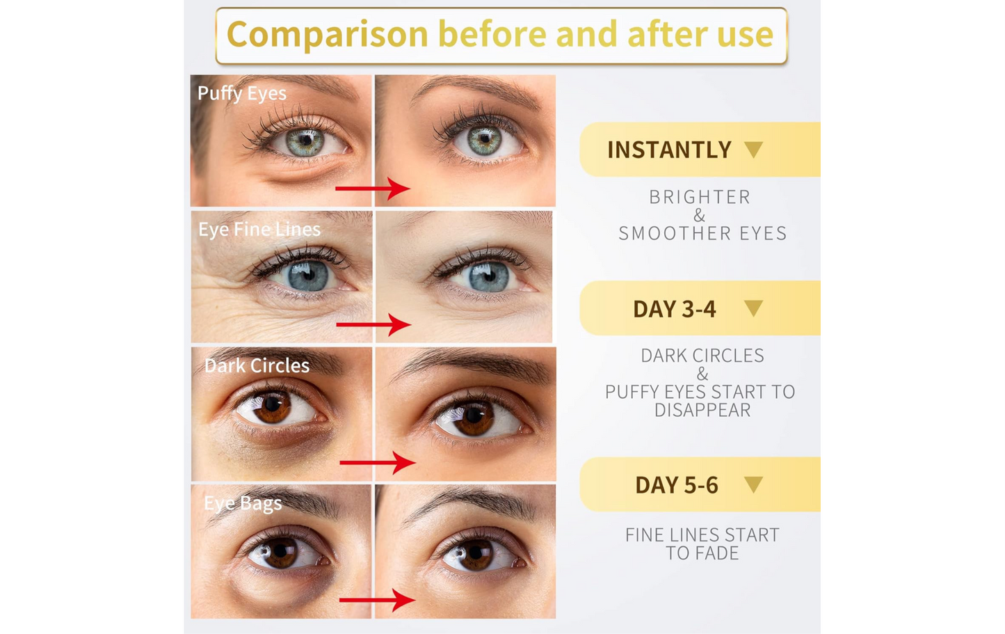 Under Eye Patches - 60 Pcs - 24K Gold Eye Mask- Puffy Eyes & Dark Circles Treatments,Reduce Under Eye Bags and Smooth Wrinkles,Eye Skin Care Pads With Collagen,Hyaluronic Acid & Castor Oil