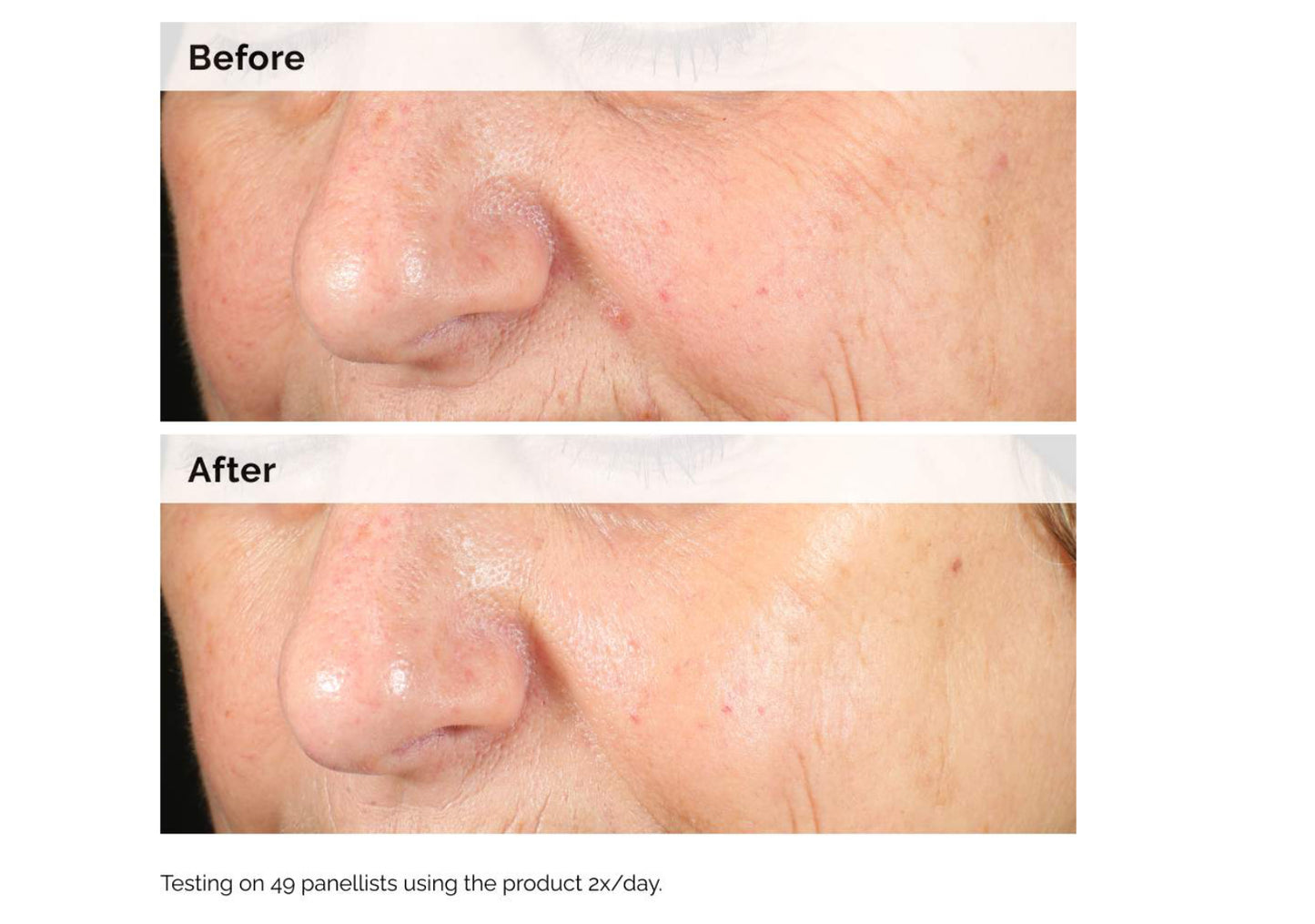 The Ordinary Alpha Arbutin 2% + HA